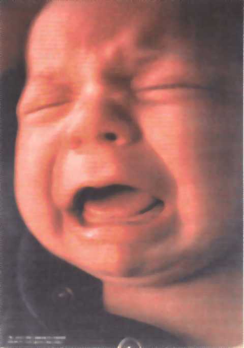 Baby in pain.